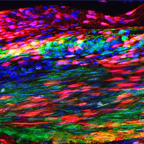 Image of the Patellar tendon 30 days after injury