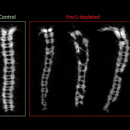  shows an example of defects in the development of the embryonic central nervous system in stored eggs that lacked the Fmr1 gene
