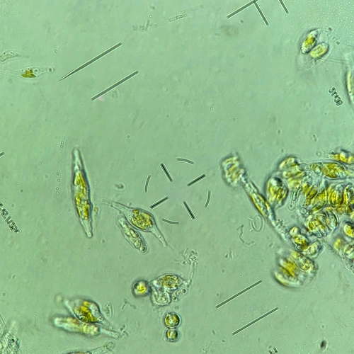Phaeodactylum tricornutum under the microscope in Carnegie Staff Scientist Adrien Burlacot’s lab. He and Stanford University’s Ellen Yeh used CRISPR to identify the genes that keeps these highly successful organisms photosynthetically efficient in fluctuating light conditions. 